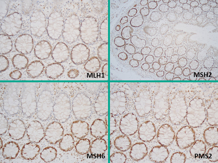 Mismatch Repair (MMR) – Control Dx